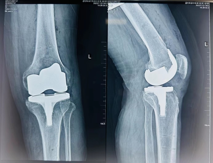 微信圖片編輯_20231218151748